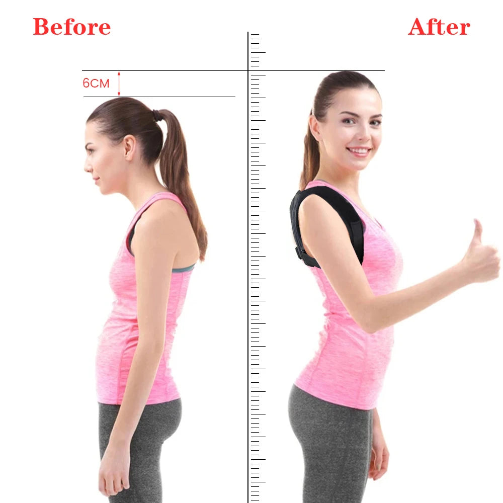 WOMENS Adjustable Back Shoulder Posture Corrector Belt Clavicle Spine Support Reshape Your Body Home Office Sport Upper Back Neck Brace
